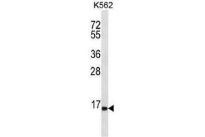 SPINK8 Antibody (C-term) western blot analysis in K562 cell line lysates (35µg/lane). (SPINK8 抗体  (C-Term))