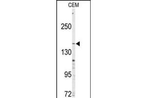 Western blot analysis of anti-ABCC4 Antibody in CEM cell line lysates (35ug/lane) (ABCC4 抗体  (C-Term))