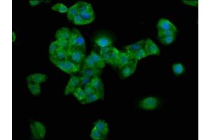Immunofluorescence staining of HepG2 cells with ABIN7161101 at 1:200, counter-stained with DAPI. (Nebulin 抗体  (AA 245-373))