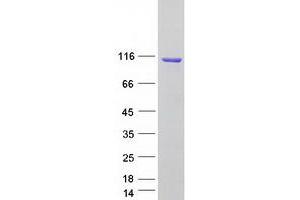 Validation with Western Blot (CYLD Protein (Transcript Variant 1) (Myc-DYKDDDDK Tag))
