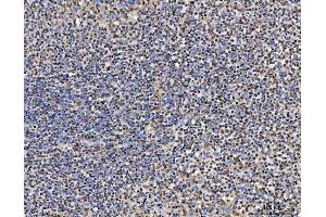 IHC analysis of TRMT10C using anti-TRMT10C antibody (ABIN7601472).