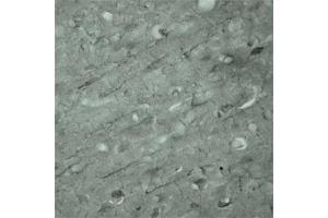 IHC on mouse brain (cryo section) using Rabbit antibody to Synaptotagmin 17  at a concentration of 50 µg/ml incubated overnight at 4C. (SYT17 抗体  (Internal Region))