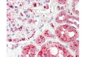Anti-TRAM1 antibody IHC staining of human kidney. (TRAM1 抗体  (AA 310-374))
