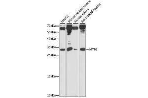 Western blot analysis of extracts of various cell lines, using MYF6 antibody (ABIN6291680) at 1:1000 dilution.