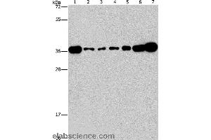 Western blot analysis of Lovo, A431, A549, hela, hepG2 and Raji cell, mouse brain tissue, using CRKL Polyclonal Antibody at dilution of 1:550 (CrkL 抗体)