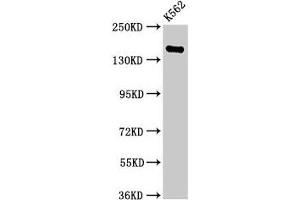 Western Blot Positive WB detected in: K562 whole cell lysate All lanes: FGD6 antibody at 2. (FGD6 抗体  (AA 1138-1352))