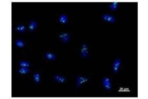 Immunostaining analysis in HeLa cells. (RPF2 抗体)