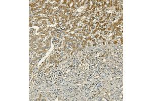 IHC analysis of LIPC using anti-LIPC antibody (ABIN7601582). (LIPC 抗体  (AA 39-494))