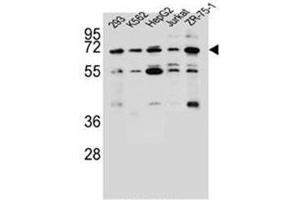 Western blot analysis of KCNV2 Antibody (C-term) in 293, K562, HepG2, Jurkat, ZR-75-1 cell line lysates (35ug/lane). (KCNV2 抗体  (C-Term))