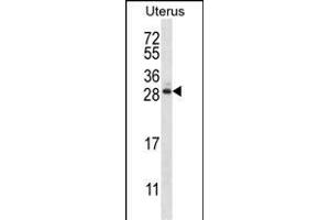 ARL8A Antibody (Center) (ABIN657381 and ABIN2846426) western blot analysis in human normal Uterus tissue lysates (35 μg/lane). (ARL8A 抗体  (AA 82-110))