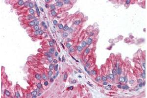 Prostate: Formalin-Fixed, Paraffin-Embedded (FFPE) (TUBA4A 抗体  (AA 1-449))
