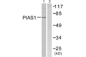 Western blot analysis of extracts from MDA-MB-435 cells, using PIAS1 antibody. (PIAS1 抗体  (N-Term))