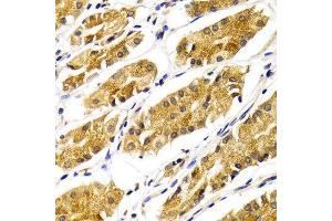 Immunohistochemistry of paraffin-embedded Human gastric using ABO antibody at dilution of 1:100 (x400 lens). (ABO 抗体)