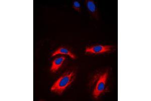 Immunofluorescent analysis of Creatine Kinase M staining in NIH3T3 cells. (CKM 抗体  (N-Term))