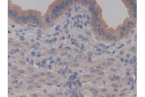 Detection of BPI in Mouse Uterus Tissue using Polyclonal Antibody to Bactericidal/Permeability Increasing Protein (BPI)