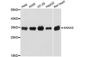 Western blot analysis of extracts of various cell lines, using ANXA3 antibody. (Annexin A3 抗体  (AA 1-323))
