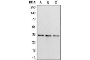 Western blot analysis of Apolipoprotein L2 expression in HepG2 (A), mouse liver (B), rat brain (C) whole cell lysates. (Apolipoprotein L 2 抗体  (Center))