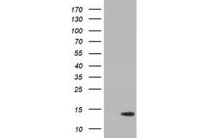 HEK293T cells were transfected with the pCMV6-ENTRY control (Left lane) or pCMV6-ENTRY RIPPLY2 (Right lane) cDNA for 48 hrs and lysed. (RIPPLY2 抗体)