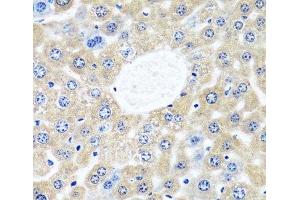 Immunohistochemistry (Paraffin-embedded Sections) (IHC (p)) image for anti-Calcium Modulating Ligand (CAMLG) antibody (ABIN7257333)