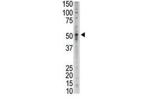Image no. 1 for anti-Growth Differentiation Factor 2 (GDF2) (N-Term) antibody (ABIN357458) (GDF2 抗体  (N-Term))