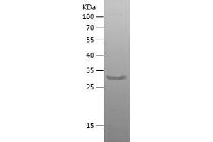 AXIN2 Protein (AA 579-843) (His tag)