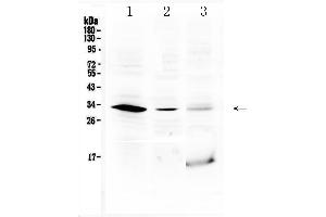 Western blot analysis of HOXB1 using anti-HOXB1 antibody .