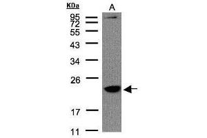 WB Image Sample(30 μg of whole cell lysate) A:Raji, 12% SDS PAGE antibody diluted at 1:1500 (TMEM147 抗体)