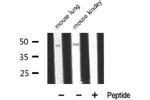 Western blot analysis of ADA2L expression in various lysates (TADA2L 抗体)