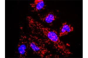 Proximity Ligation Analysis of protein-protein interactions between TBL1X and CTNNB1. (TBL1X 抗体  (AA 1-526))