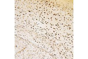 IHC analysis of SOX15 using anti-SOX15 antibody (ABIN6719624). (SOX15 抗体  (AA 1-233))