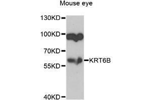 Western blot analysis of extracts of mouse eye, using KRT6B antibody (ABIN2737066) at 1:1000 dilution. (Keratin 6B 抗体)