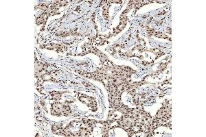 IHC analysis of SNRNP40 using anti-SNRNP40 antibody (ABIN7601719). (SNRNP40 抗体  (AA 43-357))