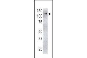 The anti-USP4 C-term Pab (ABIN388883 and ABIN2839175) is used in Western blot to detect USP4 in USP4-transfected HeLa cell lysate. (USP4 抗体  (C-Term))