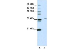 Western Blotting (WB) image for anti-Squamous Cell Carcinoma Antigen Recognized By T Cells 3 (SART3) antibody (ABIN2461855) (SART3 抗体)