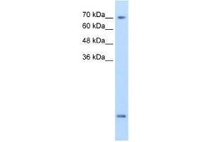 Western Blotting (WB) image for anti-Solute Carrier Family 6 (Neurotransmitter Transporter, Creatine), Member 8 (SLC6A8) (N-Term) antibody (ABIN2775317)