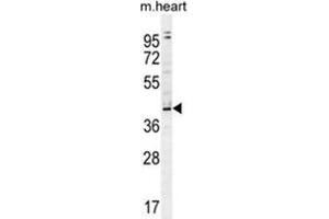 ZBTB42 Antibody (N-term) western blot analysis in mouse heart tissue lysates (35 µg/lane).