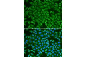 Immunofluorescence analysis of U2OS cells using PIP antibody (ABIN6131693, ABIN6145670, ABIN6145672 and ABIN6222022). (PIP 抗体  (AA 29-146))