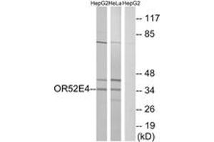 Western blot analysis of extracts from HepG2/HeLa cells, using OR52E4 Antibody. (OR52E4 抗体  (AA 200-249))