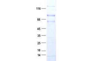 Validation with Western Blot
