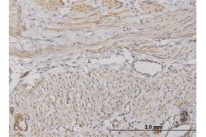 Immunoperoxidase of monoclonal antibody to CXCL5 on formalin-fixed paraffin-embedded human smooth muscle. (CXCL5 抗体  (AA 1-114))