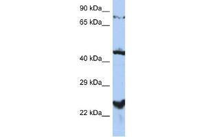 WB Suggested Anti-MRS2L Antibody Titration:  0. (MRS2 抗体  (Middle Region))
