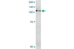Immunoprecipitation of NLRP2 transfected lysate using anti-NLRP2 MaxPab rabbit polyclonal antibody and Protein A Magnetic Bead , and immunoblotted with NLRP2 purified MaxPab mouse polyclonal antibody (B01P) . (NLRP2 抗体  (AA 1-1062))