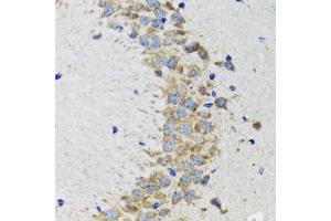 Immunohistochemistry of paraffin-embedded rat brain using CDK1 antibody. (CDK1 抗体)