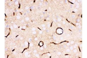 Immunohistochemistry (IHC) image for anti-Solute Carrier Family 2 (Facilitated Glucose Transporter), Member 1 (SLC2A1) (AA 92-492) antibody (ABIN3043927)
