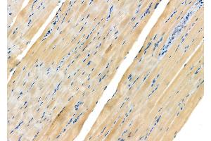 ABIN6263636 and ABIN6272362 at 1/100 staining Rat muscle tissue by IHC-P.