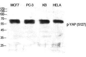 Western Blot (WB) analysis of specific cells using Phospho-YAP (S127) Polyclonal Antibody. (YAP1 抗体  (pSer127))