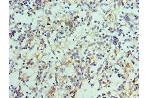 Immunohistochemistry of paraffin-embedded human spleen tissue using ABIN7156850 at dilution of 1:100 (IL-21 抗体  (AA 25-162))