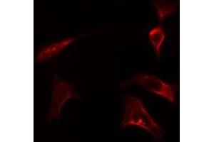 ABIN6278128 staining LOVO cells by IF/ICC. (HSPA14 抗体)