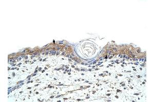 RBMS1 antibody was used for immunohistochemistry at a concentration of 4-8 ug/ml to stain Squamous epithelial cells (arrows) in Human Skin. (RBMS1 抗体  (C-Term))