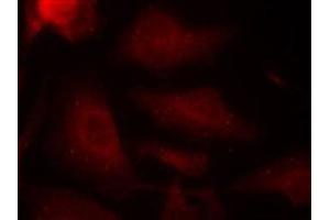 Immunofluorescent staining of methanol-fixed Hela cells using MAPT (phospho S404) polyclonal antibody  at 1:100-1:200 dilution. (MAPT 抗体  (pSer404))